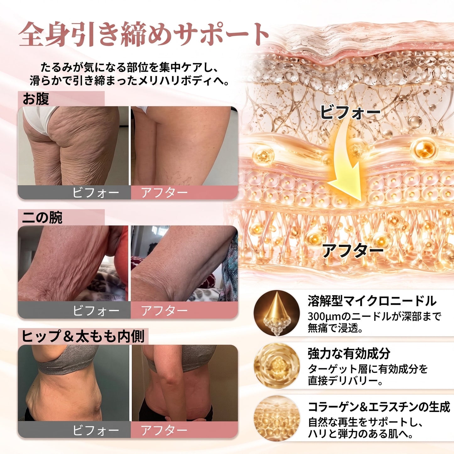 HISKIN® バストアップ・リフトアップ＆ハリ・弾力ケア マイクロニードルパッチ